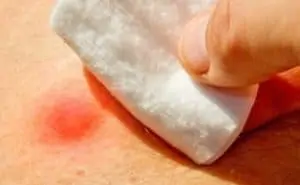 Pourquoi rêver de pus ?