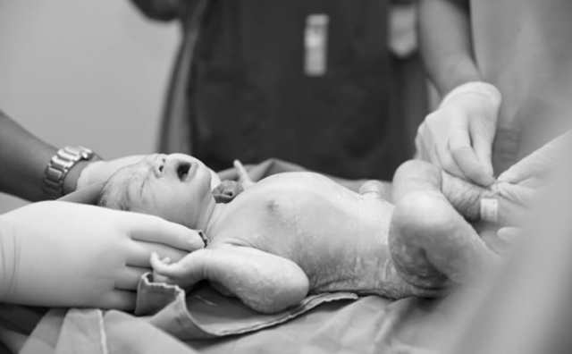 rêver de donner naissance à un bébé mal-formé