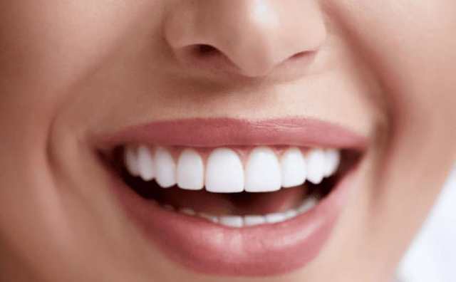 Pourquoi rêver de dents blanches ?