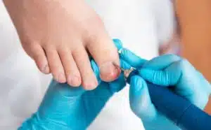 Rêver d'ongles incarnés : quelles interprétations, symbolisme et significations ?