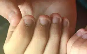 Rêver d'ongles rongés : quelles interprétations, symbolisme et significations ?